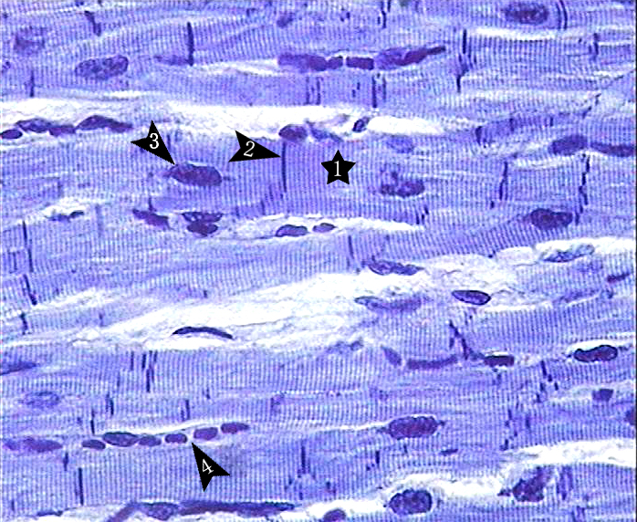 心肌纤维(cardiac muscle fiber)呈短圆柱状,有分支,互相连接成网状