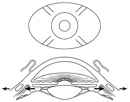 pagenumber_ebook=359,pagenumber_book=334