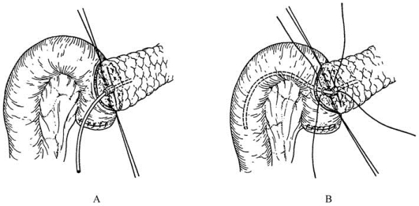 pagenumber_ebook=496,pagenumber_book=481