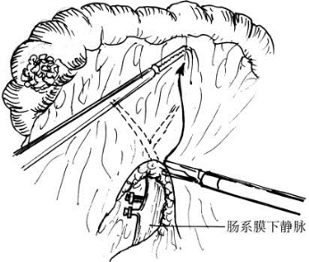 pagenumber_ebook=397,pagenumber_book=382