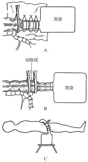 pagenumber_ebook=161,pagenumber_book=146