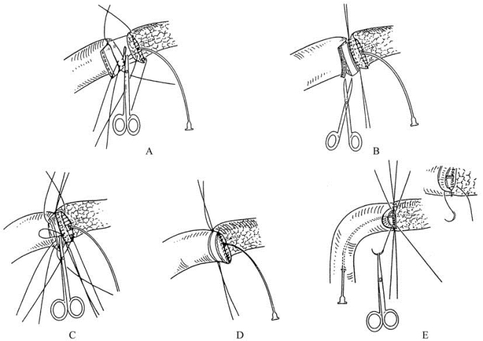 pagenumber_ebook=147,pagenumber_book=132