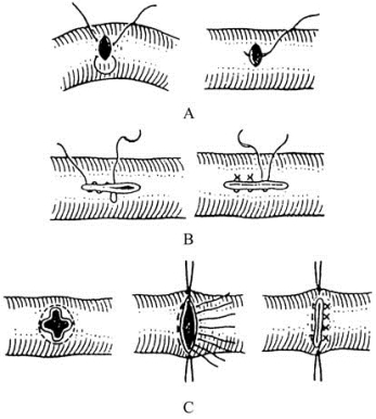 pagenumber_ebook=259,pagenumber_book=244