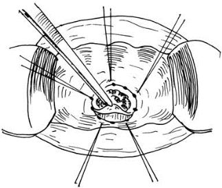 pagenumber_ebook=525,pagenumber_book=510