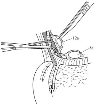 pagenumber_ebook=332,pagenumber_book=317