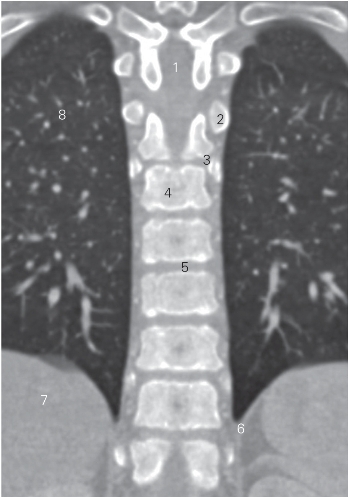 pagenumber_ebook=17,pagenumber_book=8