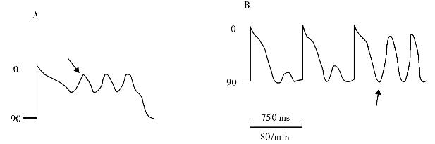 pagenumber_ebook=125,pagenumber_book=1