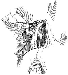 pagenumber_ebook=110,pagenumber_book=95