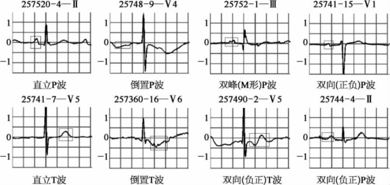 pagenumber_ebook=92,pagenumber_book=83