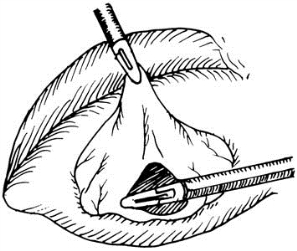 pagenumber_ebook=483,pagenumber_book=468