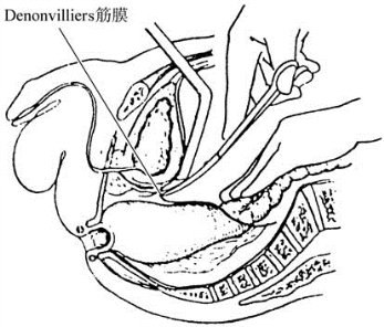 pagenumber_ebook=410,pagenumber_book=395
