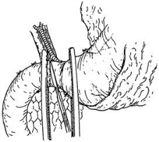 pagenumber_ebook=337,pagenumber_book=322