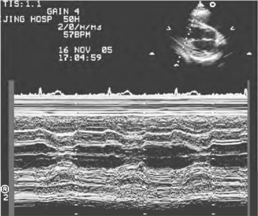 pagenumber_ebook=222,pagenumber_book=222