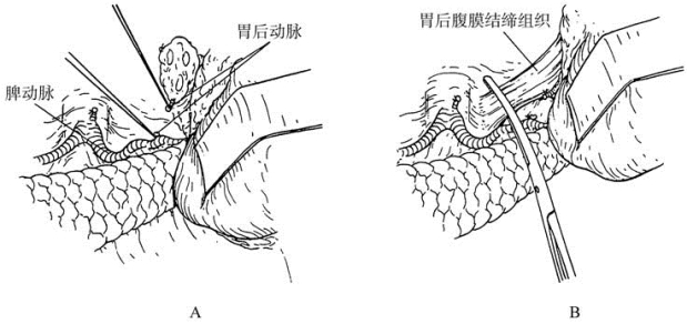 pagenumber_ebook=339,pagenumber_book=324