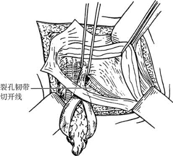 pagenumber_ebook=596,pagenumber_book=581