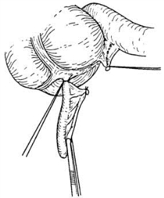 pagenumber_ebook=545,pagenumber_book=530