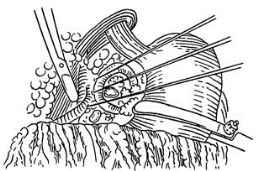 pagenumber_ebook=248,pagenumber_book=233