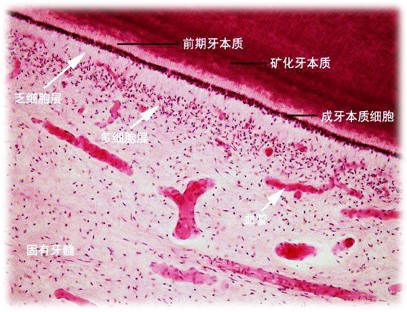 3.3-1 牙髓分层.jpg