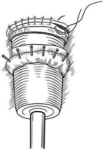 pagenumber_ebook=608,pagenumber_book=593