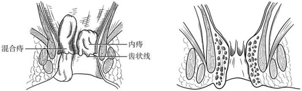 pagenumber_ebook=600,pagenumber_book=585