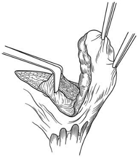 pagenumber_ebook=606,pagenumber_book=591