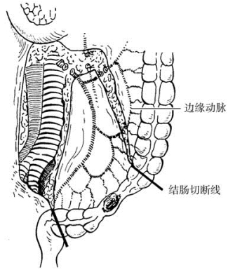 pagenumber_ebook=392,pagenumber_book=377