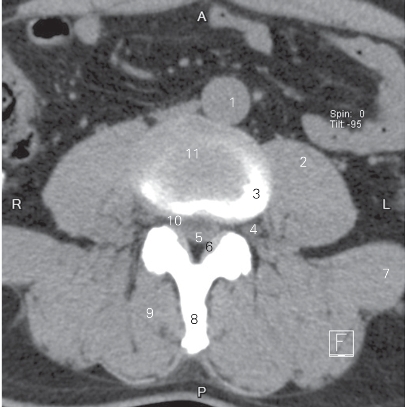 pagenumber_ebook=23,pagenumber_book=14