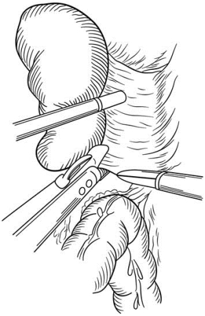 pagenumber_ebook=513,pagenumber_book=498