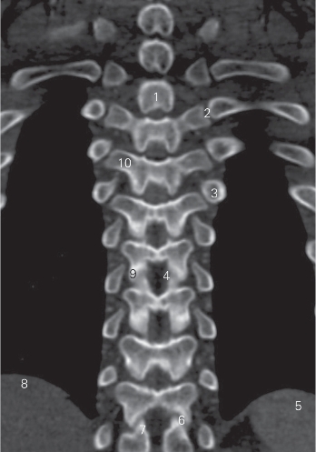 pagenumber_ebook=18,pagenumber_book=9