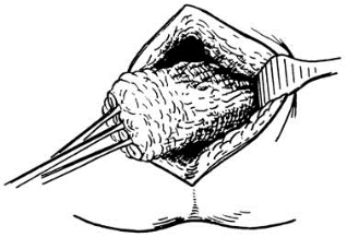 pagenumber_ebook=413,pagenumber_book=398