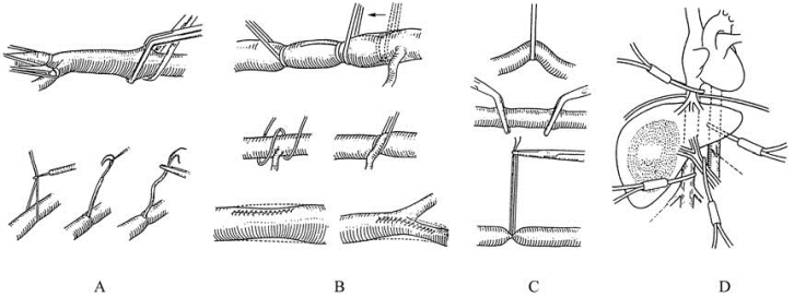 pagenumber_ebook=257,pagenumber_book=242