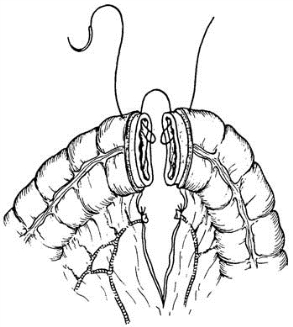 pagenumber_ebook=384,pagenumber_book=369