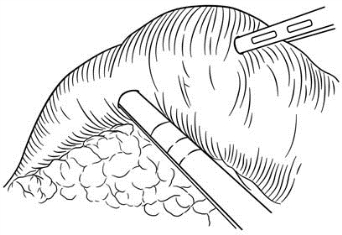 pagenumber_ebook=358,pagenumber_book=343