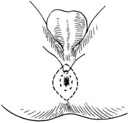 pagenumber_ebook=412,pagenumber_book=397