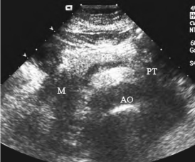 pagenumber_ebook=571,pagenumber_book=571