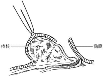 pagenumber_ebook=605,pagenumber_book=590