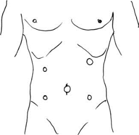 pagenumber_ebook=396,pagenumber_book=381