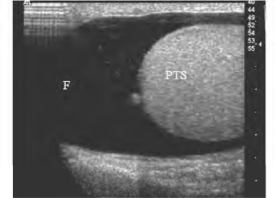 pagenumber_ebook=648,pagenumber_book=648