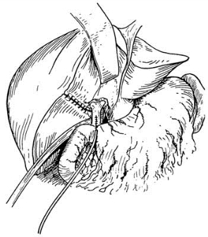 pagenumber_ebook=440,pagenumber_book=425