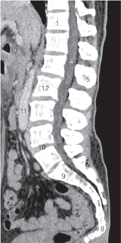 pagenumber_ebook=26,pagenumber_book=17