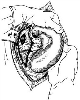 pagenumber_ebook=509,pagenumber_book=494