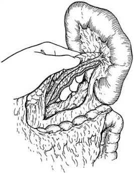 pagenumber_ebook=560,pagenumber_book=545