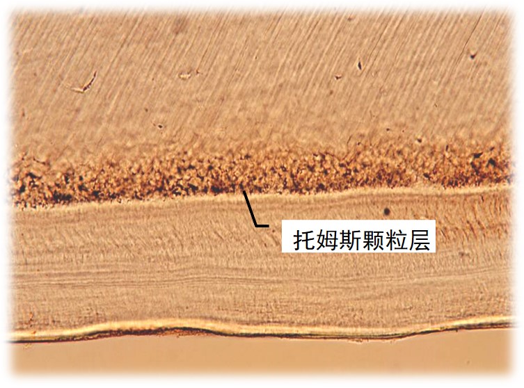 3.2-7 托姆斯颗粒层.jpg