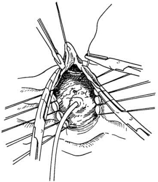 pagenumber_ebook=445,pagenumber_book=430