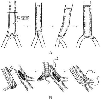 pagenumber_ebook=261,pagenumber_book=246
