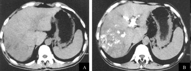 pagenumber_ebook=289,pagenumber_book=274