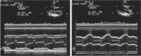pagenumber_ebook=224,pagenumber_book=224