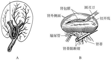 pagenumber_ebook=123,pagenumber_book=108