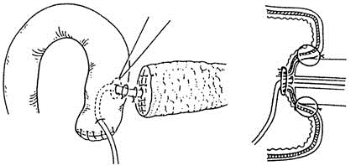 pagenumber_ebook=148,pagenumber_book=133