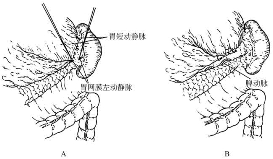 pagenumber_ebook=337,pagenumber_book=322